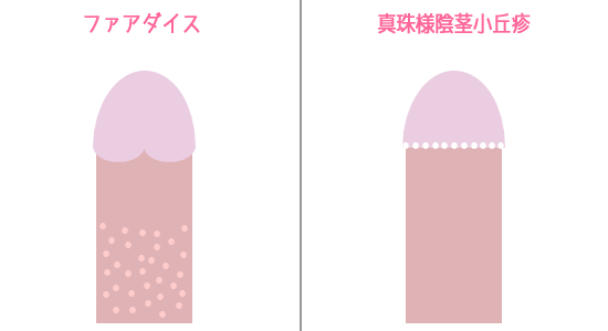 �t�H�A�_�C�X�E�^��l�A�s���u�]�͍Ĕ��̉\��������